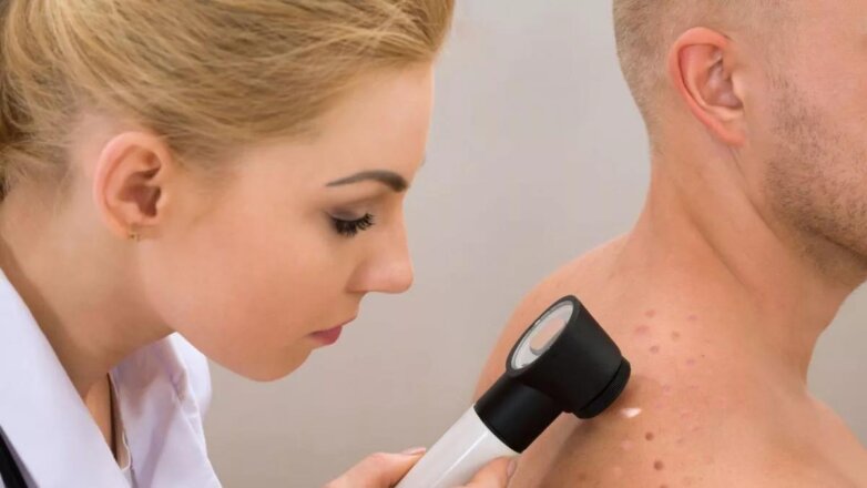 Знать риски рака кожи